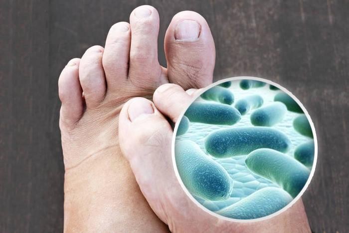 网红洞洞拖鞋简约踩屎感,踩屎感网红拖鞋厚5cm夏季