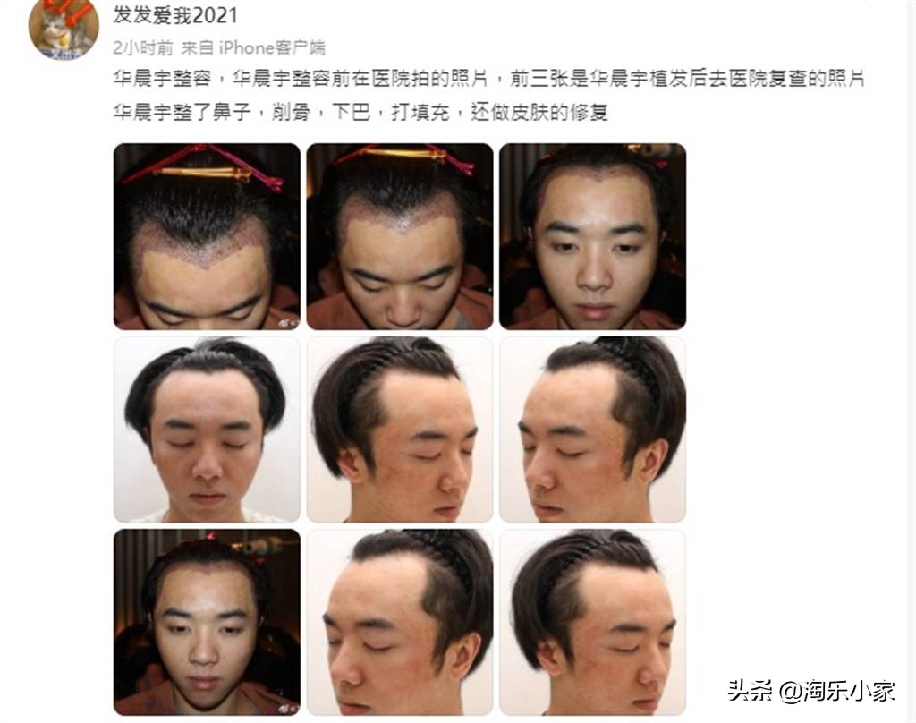 华晨宇照片张碧晨,华晨宇张碧晨最新八卦