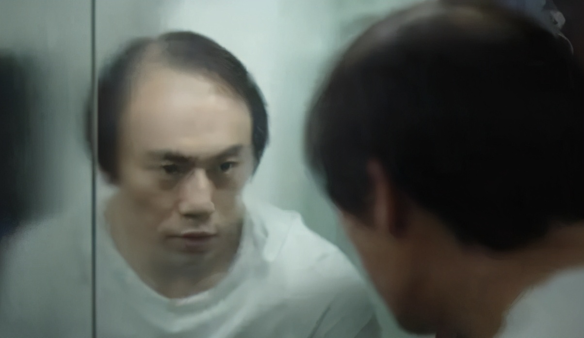 有什么动物特别容易掉毛,动物天天掉毛为什么不秃