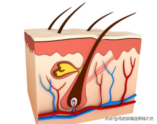 毛囊脱发怎么治疗最有效,治疗脱发有什么办法吗