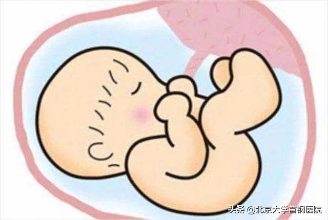 胎盘增厚，是代表着胎盘早剥了吗？