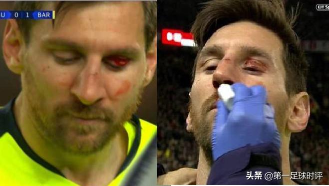 梅西孤独的王者,梅西孤独