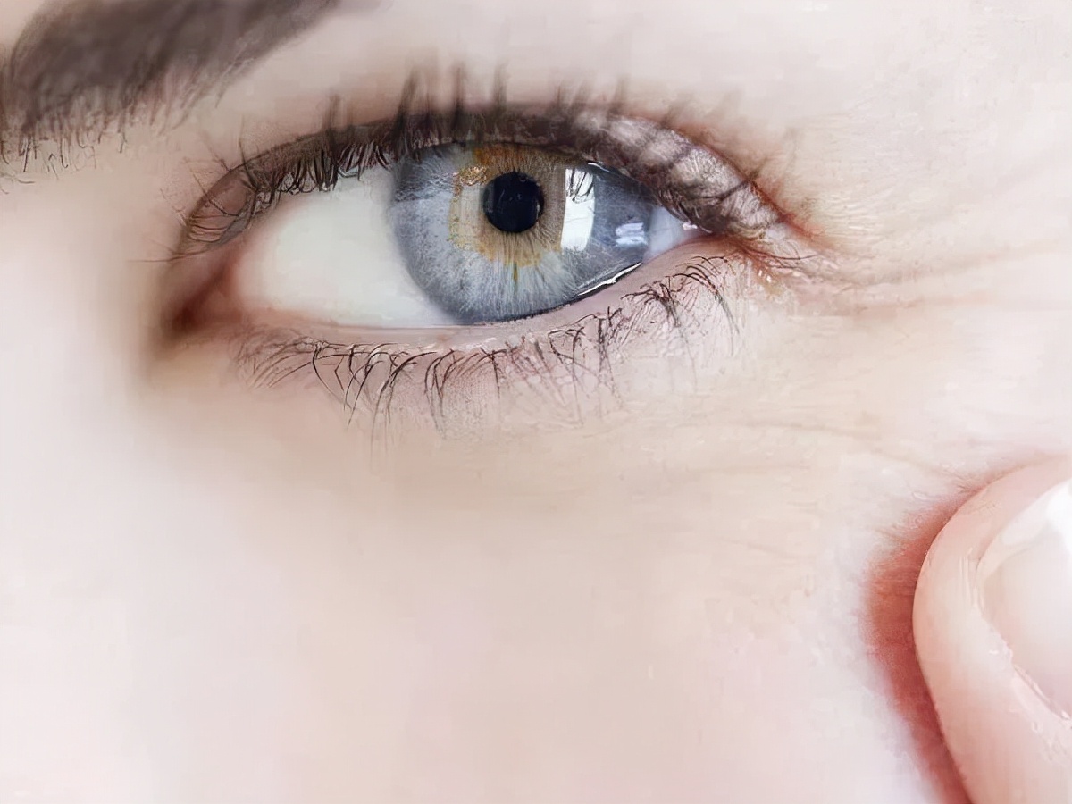 淡化法令纹鱼尾纹眼纹膏,去眼袋眼纹鱼尾纹30岁