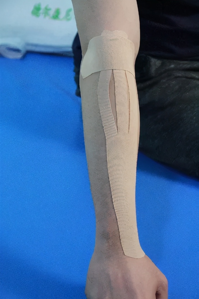 弹性贴布的原理,弹性贴布的作用