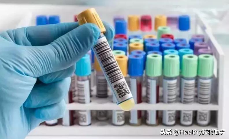 十大注意事项让肺癌患者活得更久,肺癌少遭罪又有效的治疗方法