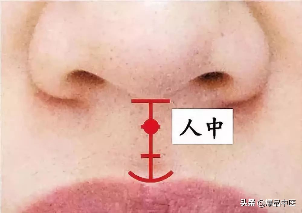 中医针灸睾丸坠痛特效穴,消除疼痛十大特效穴图解