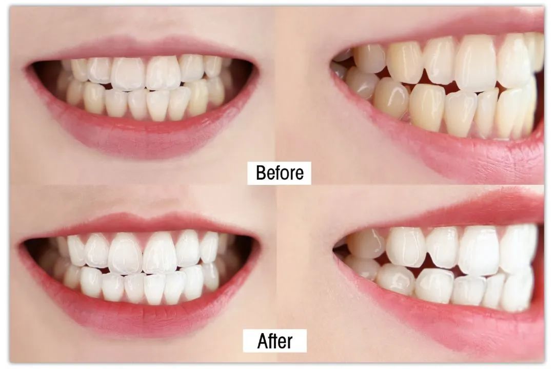 简单三招告别口臭尴尬,口臭的小妙招一招搞定