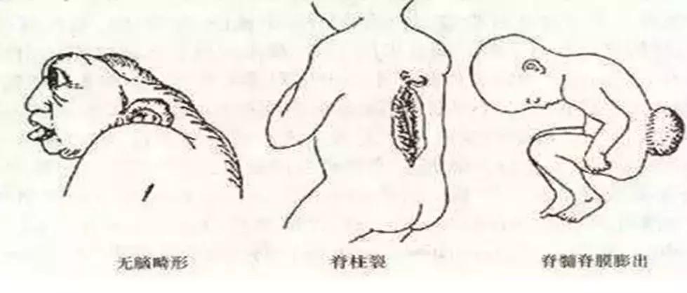 叶酸是备孕时候吃还是怀孕期间吃,备孕期间吃什么叶酸有助于怀孕