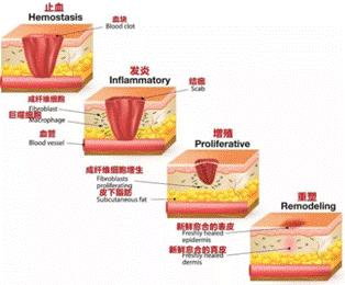 剖腹产难看的疤痕教你轻松美化,剖腹产疤痕恢复经历真实讲述
