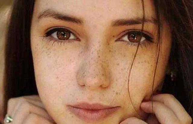 长褐斑该涂什么护肤品,褐青色斑治疗后几天可以洗脸