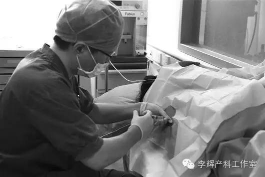 人民医院产科麻醉与镇痛,产科麻醉全过程