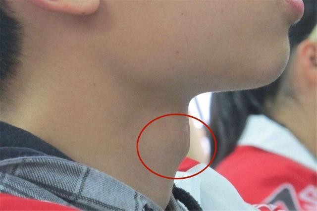 13岁男孩骨骺线基本上闭合怎么办,十四岁男孩骨骺线会提前闭合