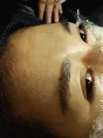 激光美容有哪些项目,激光美容都有哪些项目