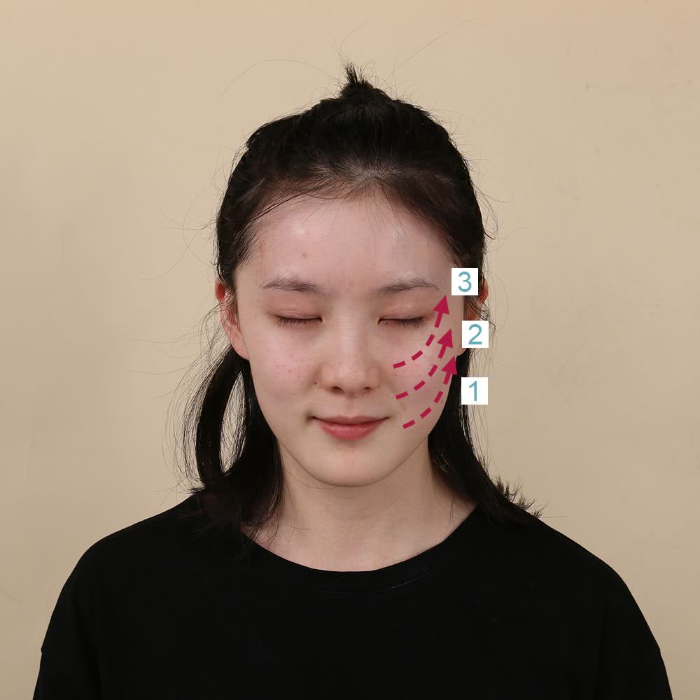 微整的真实效果,微整蜕变过程