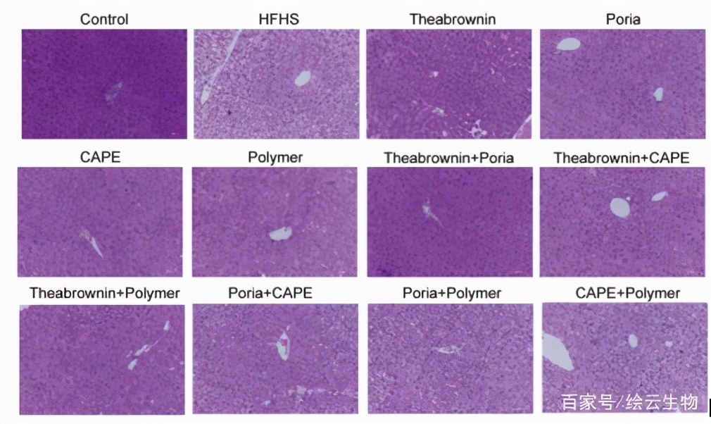 预防三高的中药粉,预防胆固醇和甘油三酯过高药物