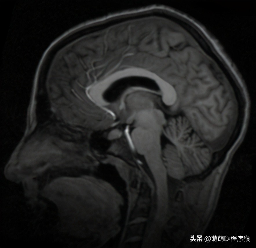 图像识别算法方程,图像锐化算子的常用算法