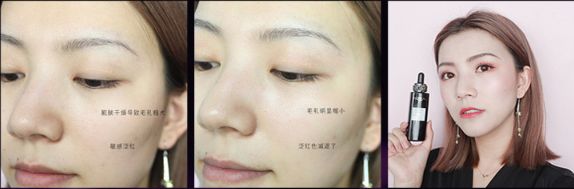 olay和欧莱雅哪个值得购买,欧莱雅和olay哪个性价比高