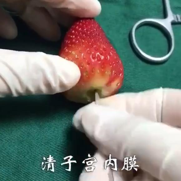 做人流跟刮子宫内膜的区别,做过人流宫口会有变化吗