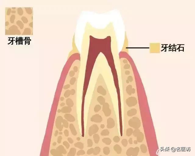 牙齿松动如何固齿,牙齿为什么会松动