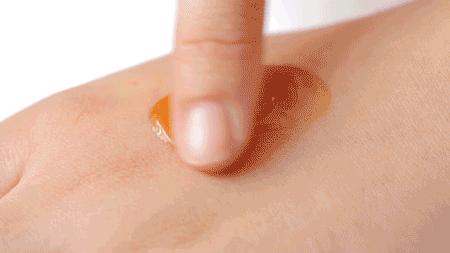 抗痘抑菌凝胶,祥顺比尔霍夫抑菌凝胶治理皮癣