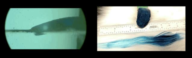 孩子膀胱容量130,儿童最大膀胱容量197正常吗