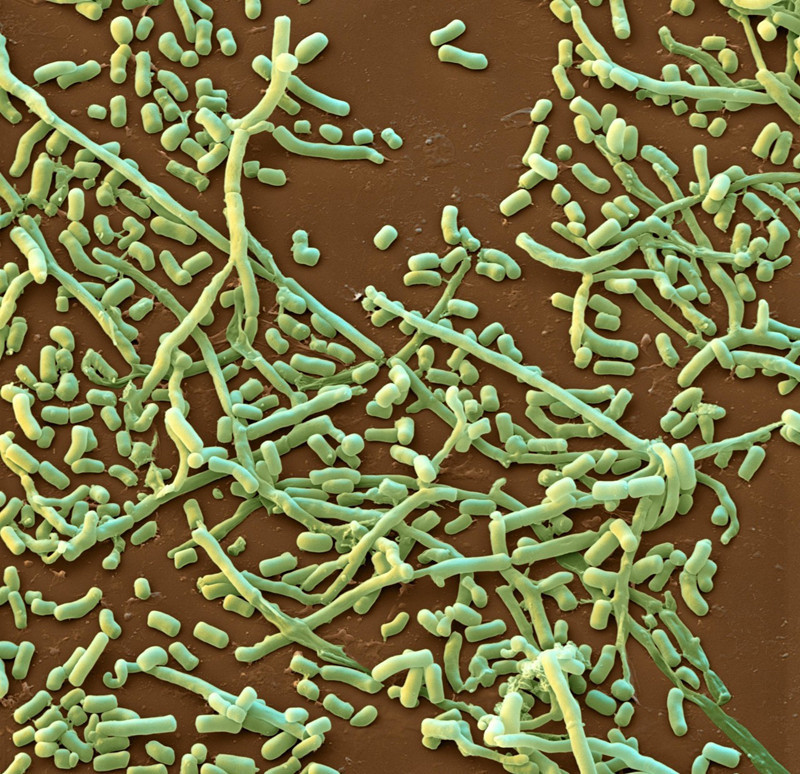 为什么霉菌感染的疾病总是不会好？医生告诉您