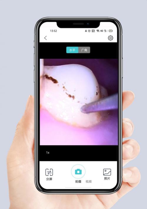 小米素诺声波洁牙仪拆解,素诺可视超声波洁牙仪t11pro价格