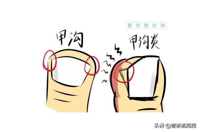 孩子吮吸手指是什么原因,喜欢吮吸手指是什么行为