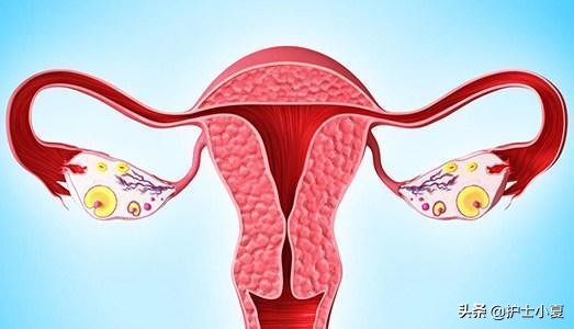 女人得了盆腔炎症该注意哪些,盆腔炎怎么预防和改善