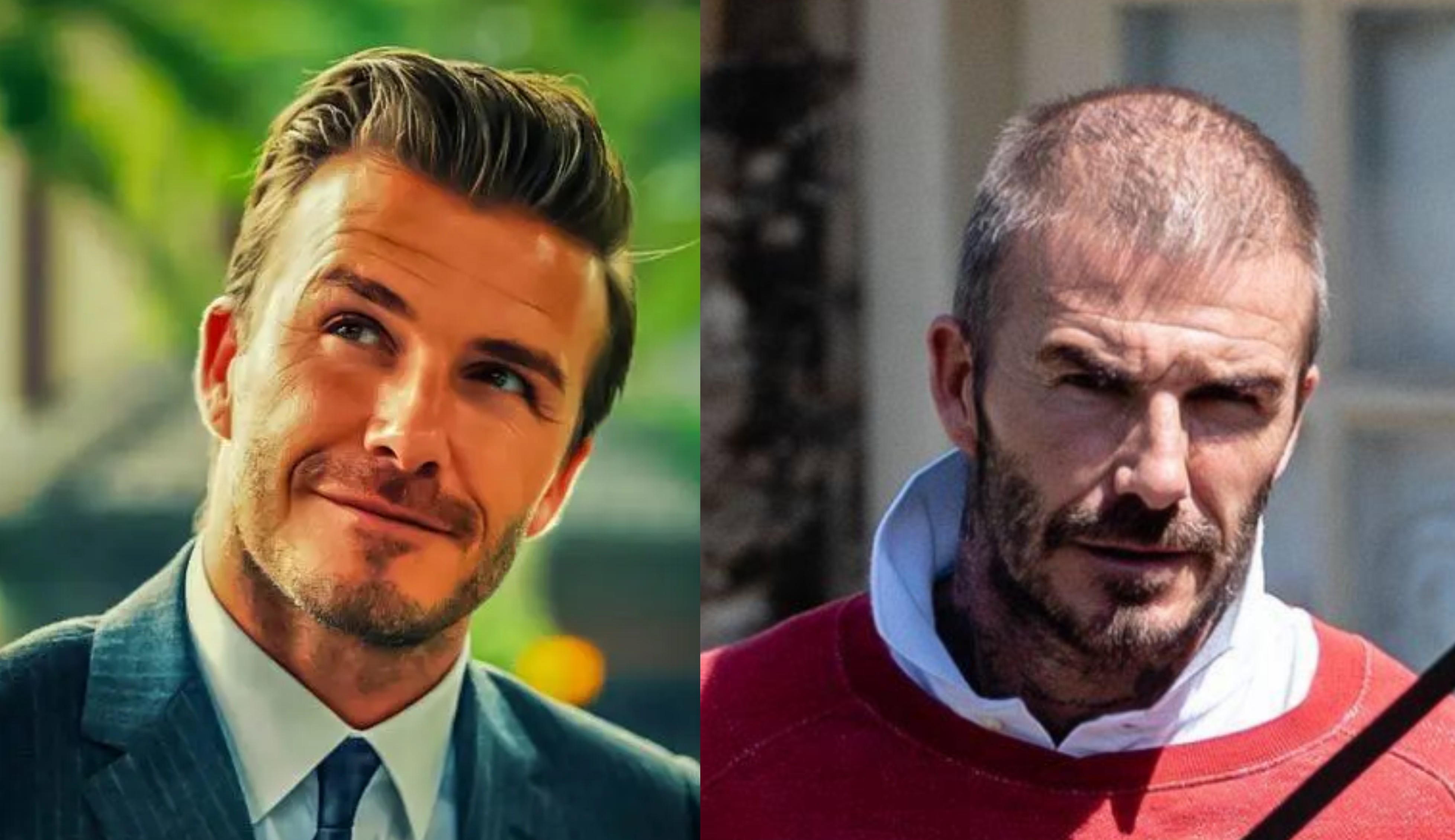 m型脱发也帅的男明星,帅气也挡不住脱发的10位男明星