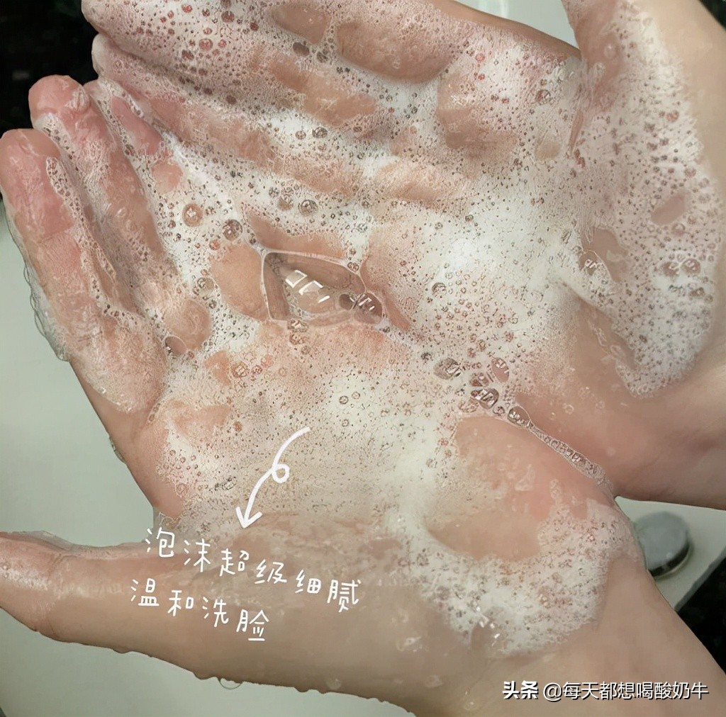 脸部毛孔大泛红有红血丝,脸部毛孔粗大有红血丝怎么改善