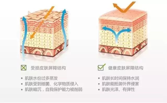 角质层薄脸上有红血丝怎么调理,角质层薄有红血丝脸发红怎么修复