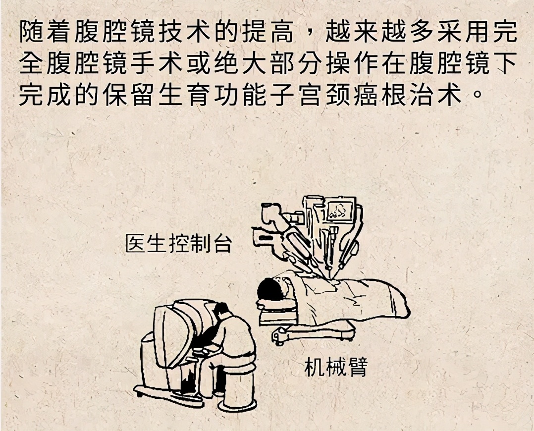 解决宫颈癌发生最好的治疗是什么,宫颈癌微创专家