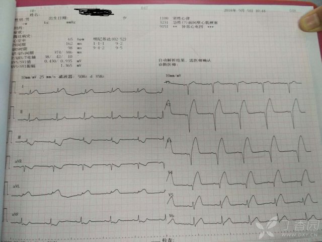 心电图心肌缺血冠脉造影正常,心脏彩超心电图冠脉造影正常
