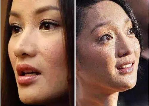 缩毛孔的有效方法平价,缩毛孔最有效的产品