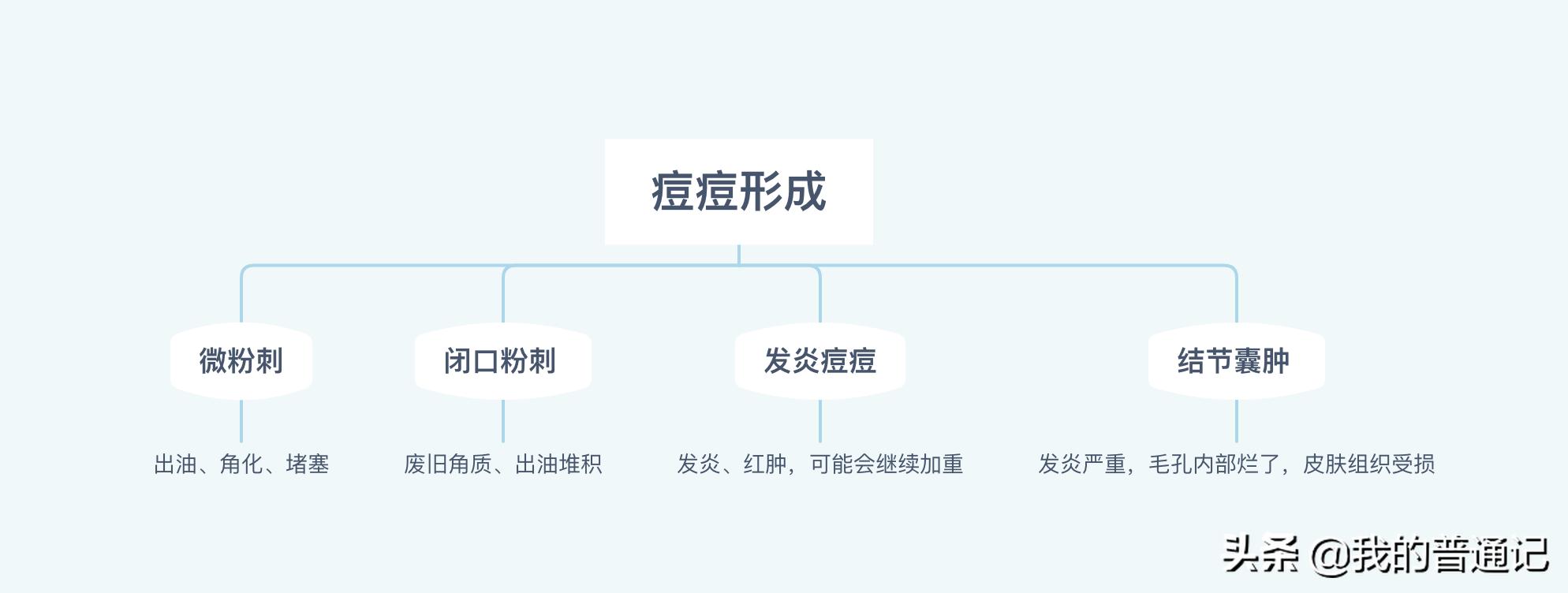 祛痘全攻略脸上痘痘真的干净了,祛痘去闭口粉刺附近美容院