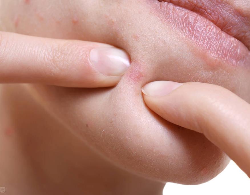 肉中脂肪粒怎么才能让它长出来,预防密集性脂肪粒最有效方法