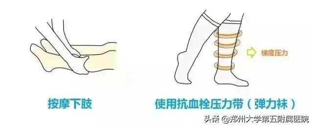 孕期下肢静脉血栓孩子真不能要吗,孕期下肢血栓的症状有哪些