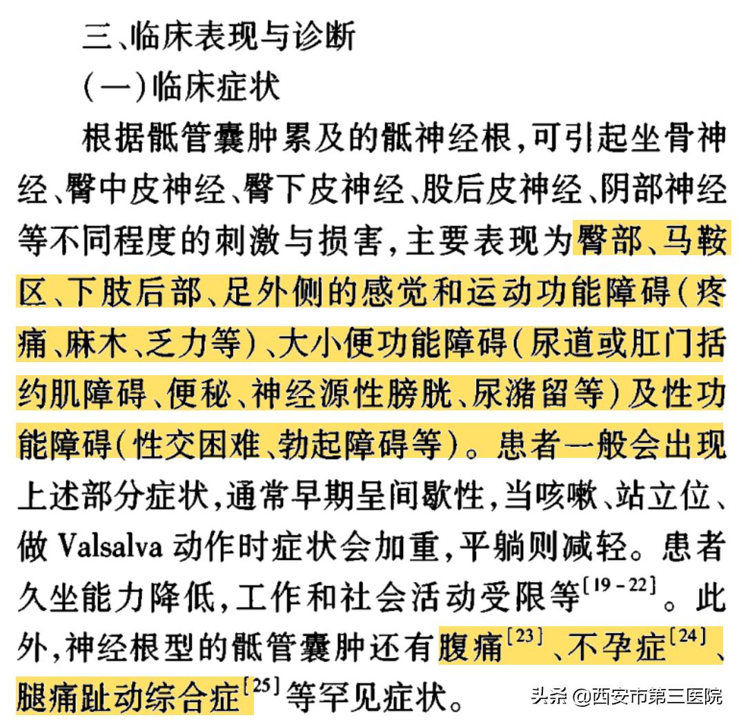 【医者解读】揭开“骶管囊肿”之神秘面纱，查出骶管囊肿都需要治疗吗？（手术病例+文献回忆）