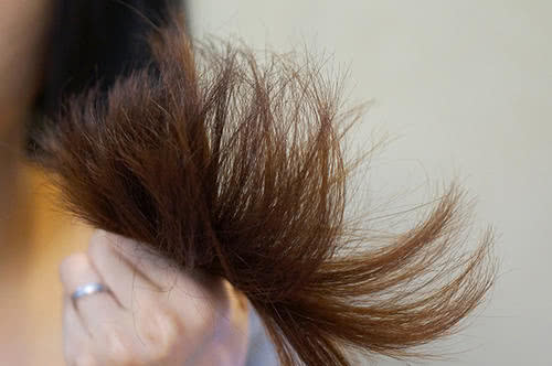 经常早上洗头发会掉头发吗,洗头头发掉发严重是什么原因