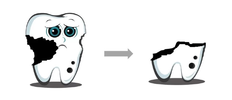 良心牙医不建议拔残根,牙医没拔干净有残根会怎样