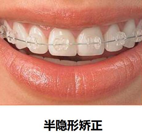 关于开口腔门诊的知识,带您一分钟了解诊所