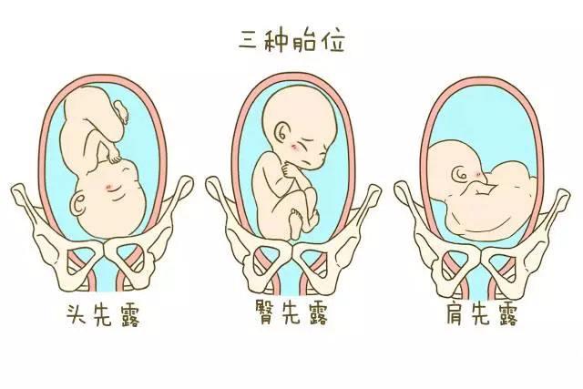孕晚期胎心在肚脐右边胎位正吗,胎心与肚脐平行是什么胎位