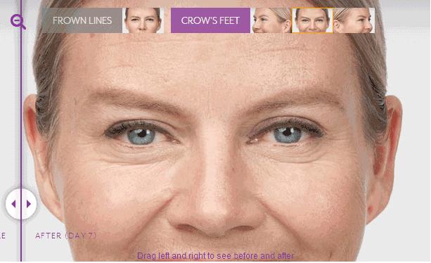 BOZ宝致|抗衰干货！我希望等到60岁依然是你们眼中的小可爱