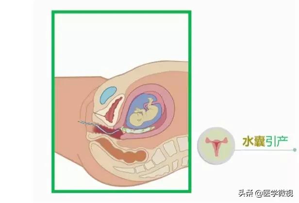 避孕套挤进宅家热销榜前十！怀孕这件事，请做好这2个准备