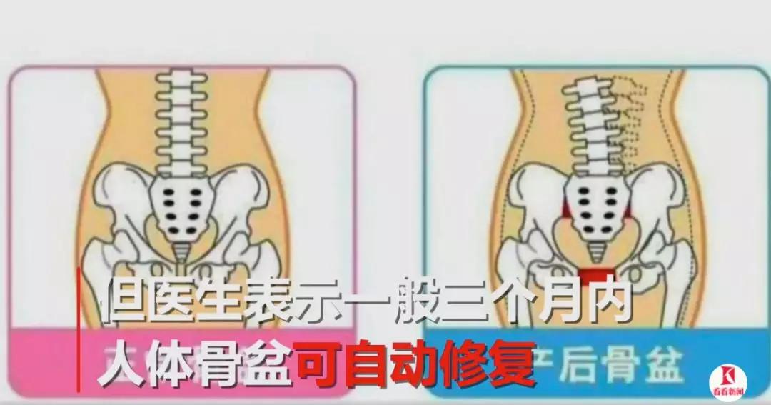 产后4个月做骨盆闭合后疼到跪地：这样做骨盆修复都是在坑妈