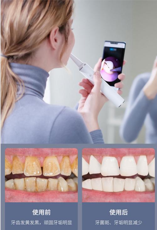 小米素诺声波洁牙仪拆解,素诺可视超声波洁牙仪t11pro价格