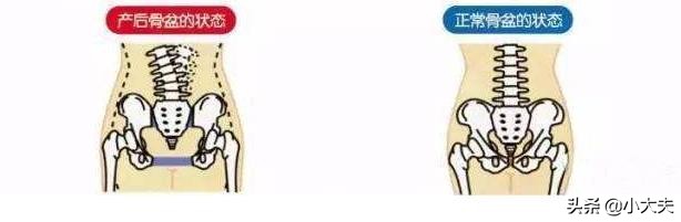 宝妈月子腰疼是什么原因,产后腰痛怎么在月子里调养好