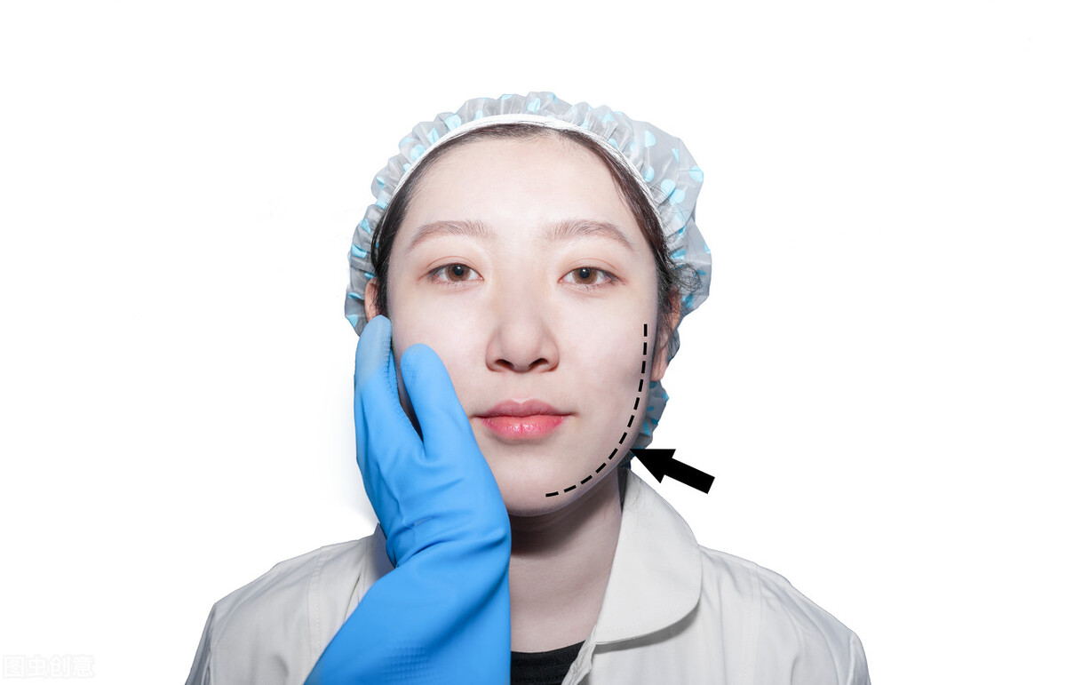 防止中年发腮的有效办法,女人中年发腮怎么解决