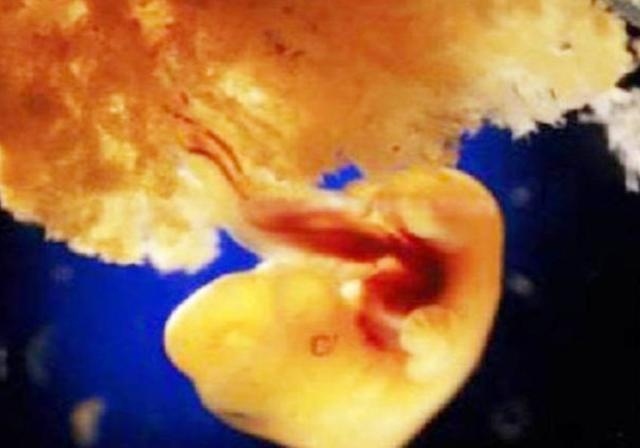 组图*放播**精子和卵子结合全过程，精子：找个媳妇，太难了